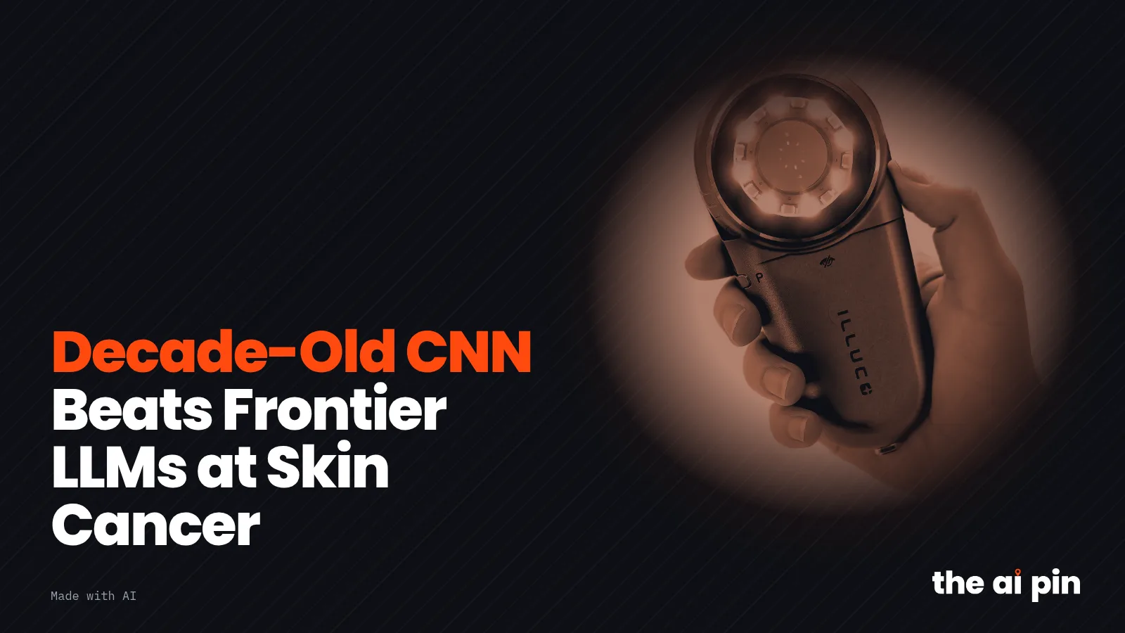 ポスター: "Decade-Old CNN Beats Frontier LLMs at Skin Cancer", リングライトを点灯させたダーマトスコープを手に持つ手のカラー写真(写真: Abessemans94, CC BY-SA…